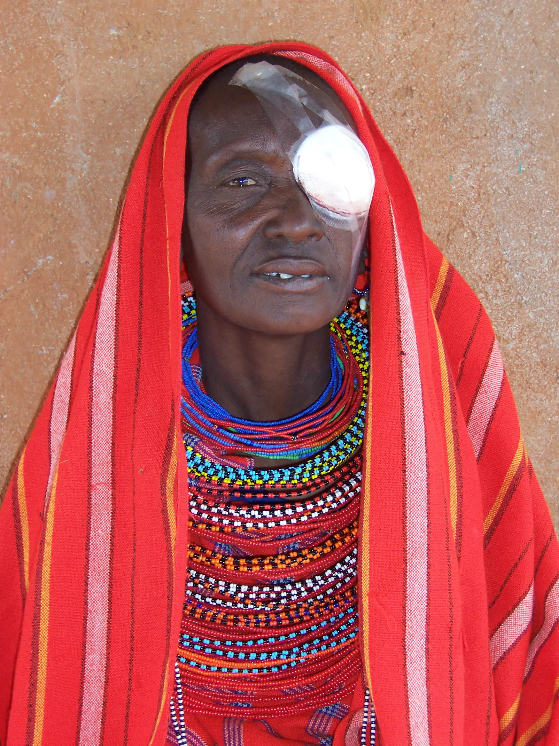 Another happy cataract patient with Dan