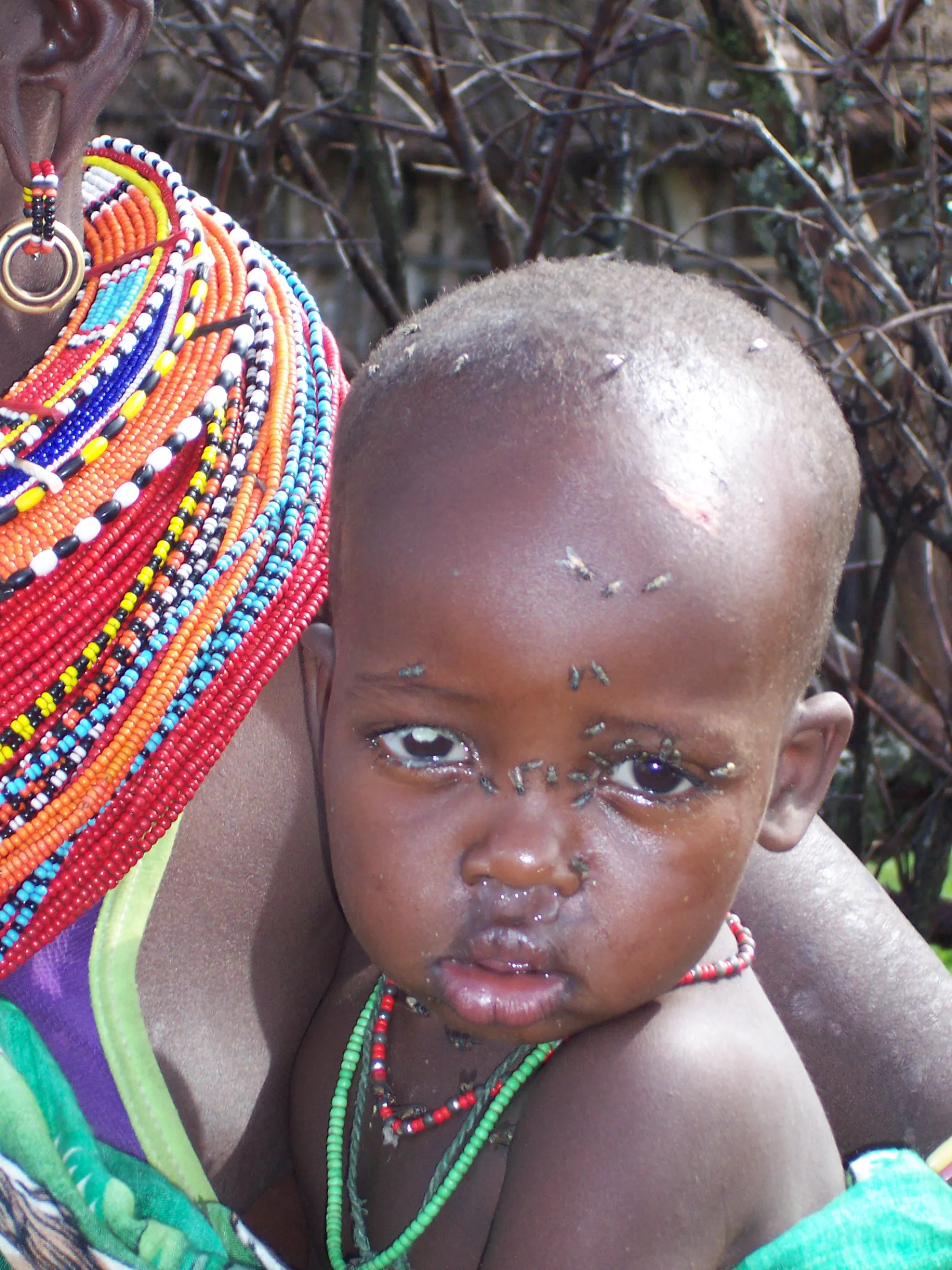 Another happy cataract patient with Dan